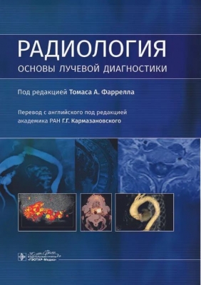 Радиология. Основы лучевой диагностики. 2024 г. 456 с.